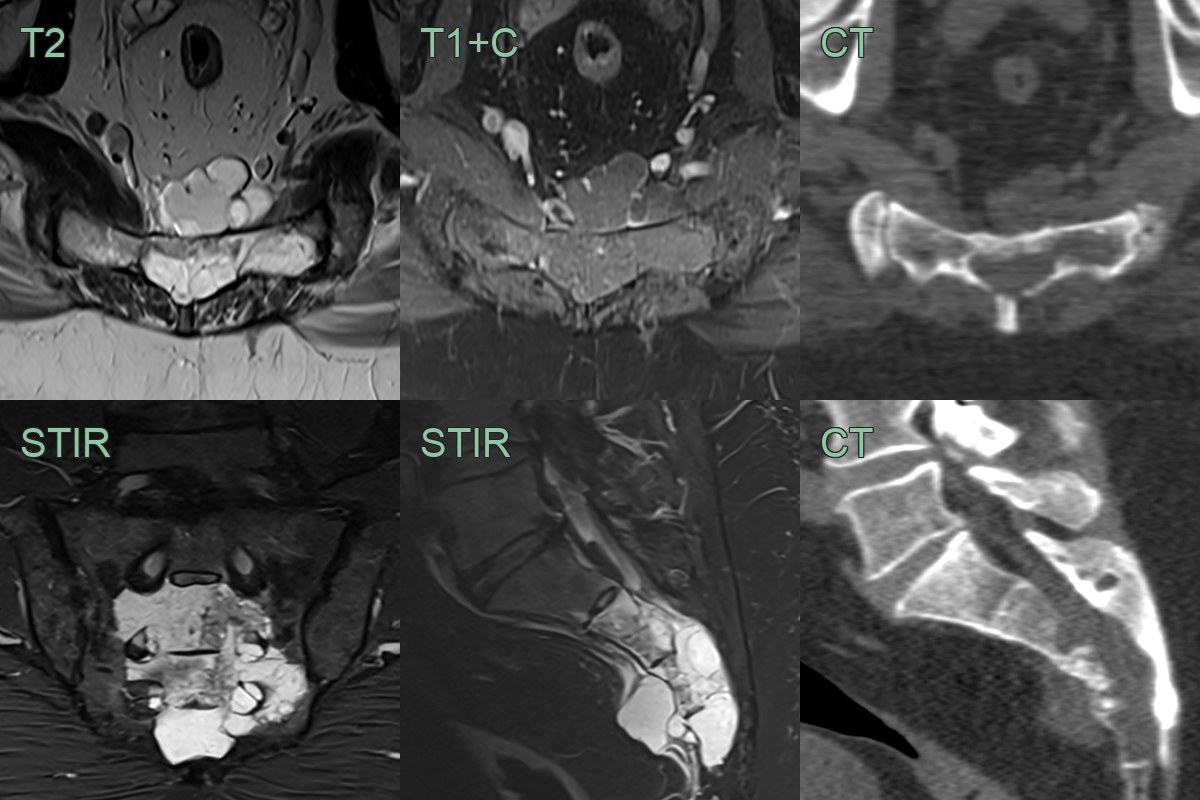 panels-1